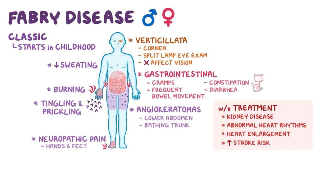 Fabry Disease